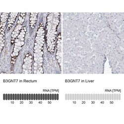 B3GNT7 Antibody, Novus Biologicals 0.1mL; Unlabeled:Antibodies, Polyclonal